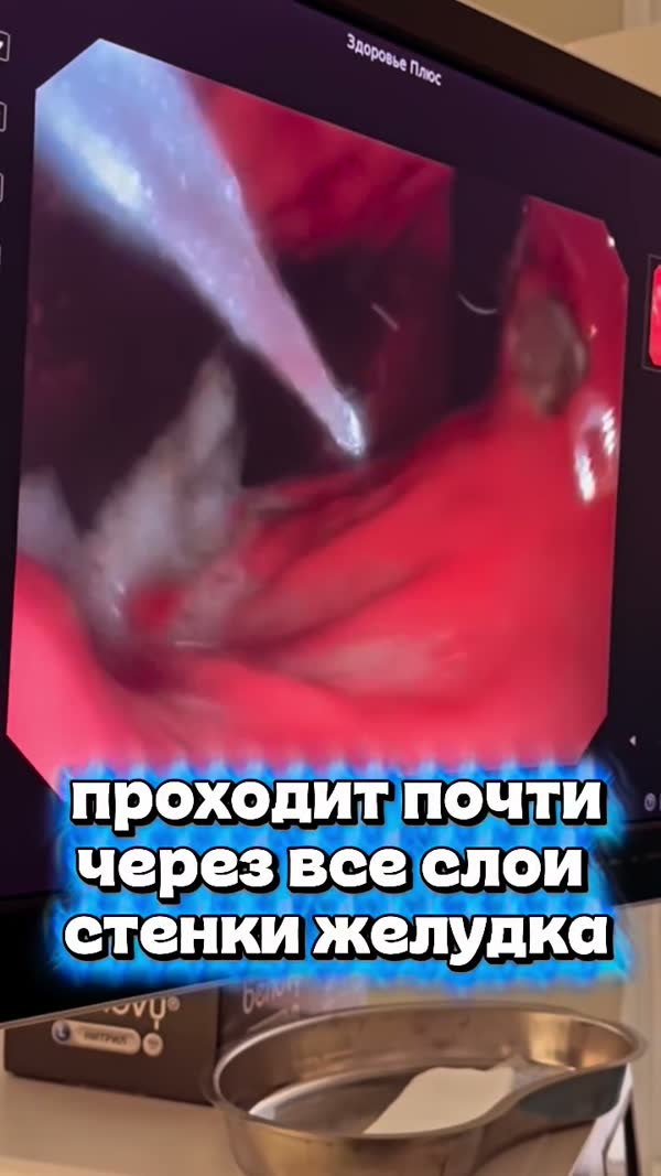 Случай из практики